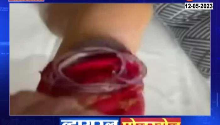  Does sleeping with onion in socks cure fever, cold