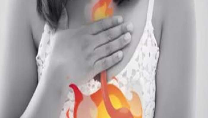 health tips know the best home remedies for acidity and acid reflux 