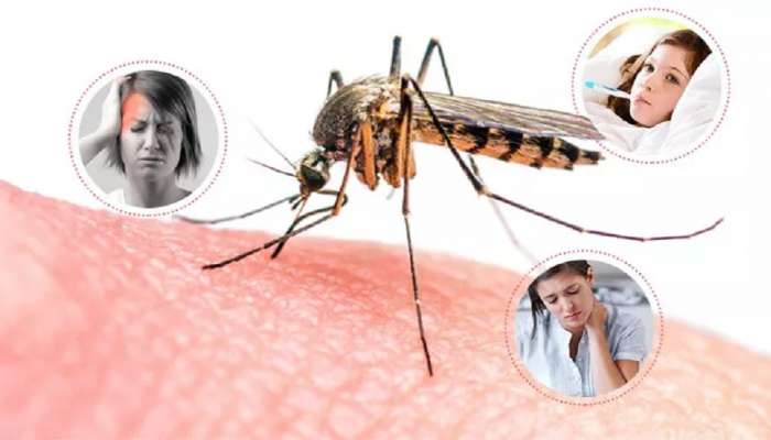 Monsoon Diseases : मंडळी पावसाळा येतोय! डेंग्यूचे प्रकार, लक्षणे आणि उपाय जाणून घ्या