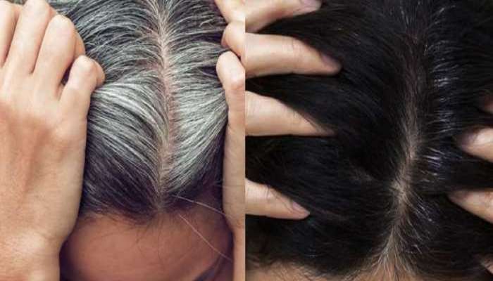 White Hair problems : तुम्हीचेही केस पांढरे होतायत? जाणून घ्या कारणं आणि त्यावर उपाय 