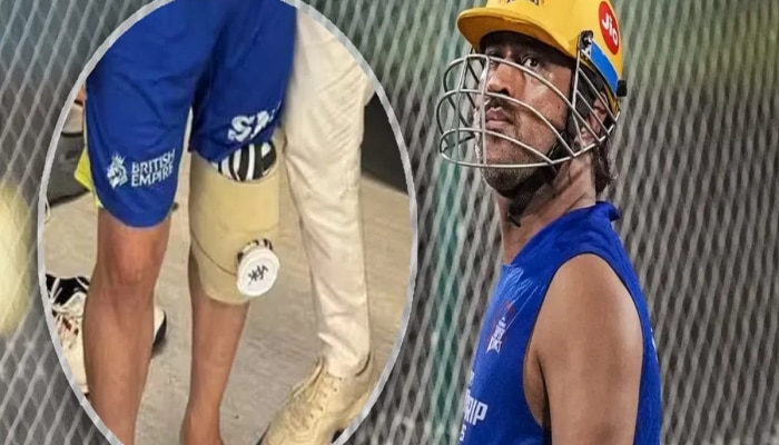 MS Dhoni : आधी पंत आणि आता धोनीच्या पायावर यशस्वी शस्त्रक्रिया, पाहा कोण आहेत &#039;ते&#039; नामांकित डॉक्टर