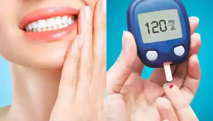 Diabetes ची &#039;ही&#039; दोन लक्षणे तोंडाच्या आतील भागात दिसतात, तुम्हालाही हा त्रास जाणवला का?