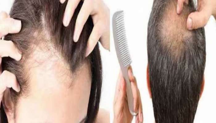 Hairfall Problem: थंड पाण्याने केस धुताय, थांबा! होऊ शकतं नुकसान, कसं ते पाहा