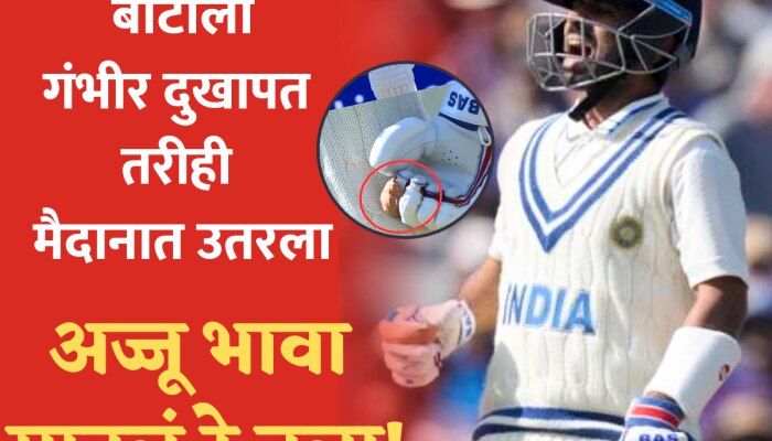 Ajinkya Rahane: बोटाला गंभीर दुखापत तरीही मैदानात उतरला.. दादाला उत्तर देत म्हणाला, जिंकणारच!