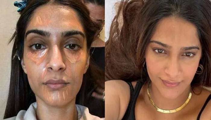नो मेकअप लुकमध्ये अशी दिसते सोनम कपूर; डार्क सर्कल्स पाहून तुम्हाला बसेल आश्चर्याचा धक्का 