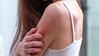 पावसाळ्यात वारंवार त्वचेचा संसर्ग होतोय? साध्या-सोप्या उपायांनी टाळता येईल इन्फेक्शन
