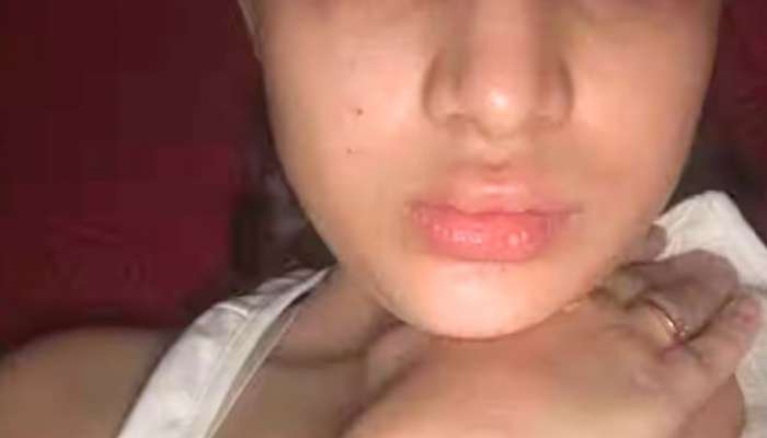 urfi javed, urfi javed lip fillers, entertainment, entertainment news, bollywood, bollywood news, lip fillers, eye fillers, lip fillers affect, urfi javed lip fillers painful, lip fillers painful, 