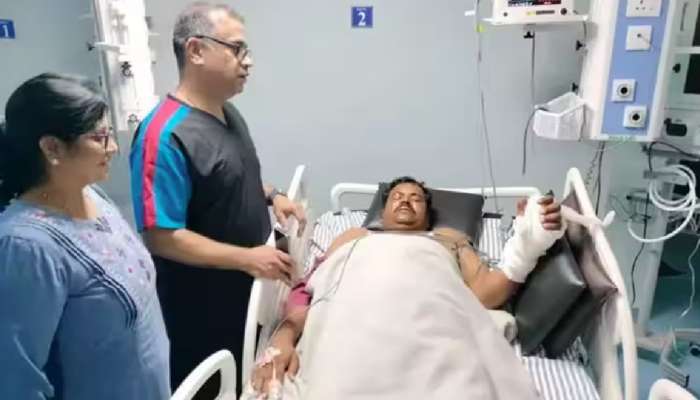 देवमाणूस! डॉक्टरांनी एक पैसाही न घेता जोडला मजूराचा तुटलेला पंजा; 8 तास चाललं ऑपरेशन