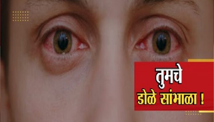 तुमचे डोळे लाल तर झाले नाहीत ना! देशात Eye Flu संकट...पाहा काय काळजी घ्याल