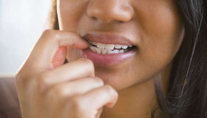 तुम्हीदेखील बसल्याबसल्या नखं चावता का? दातांचे होऊ शकते गंभीर नुकसान