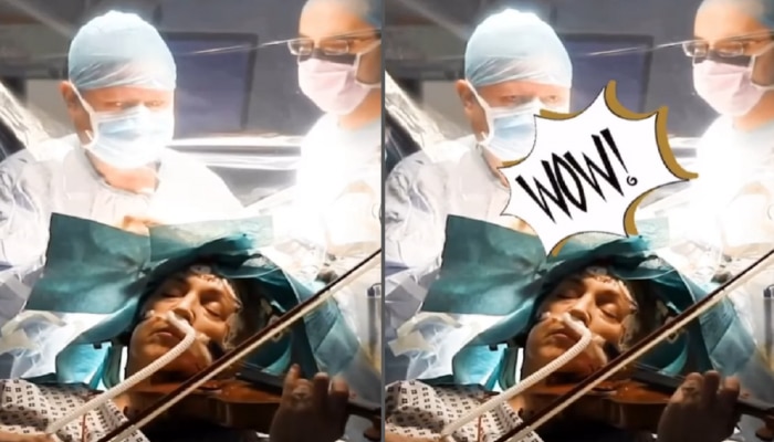 Video : मेंदूच्या शस्त्रक्रियेदरम्यान स्वत:च व्हायोलिन वाजत होती वृद्ध महिला, व्हिडीओ पाहताच डोळ्यात पाणी