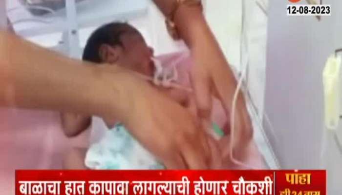 A 52-day-old baby's hand had to be amputated due to the carelessness of doctors at Mumbai's KEM Hospital