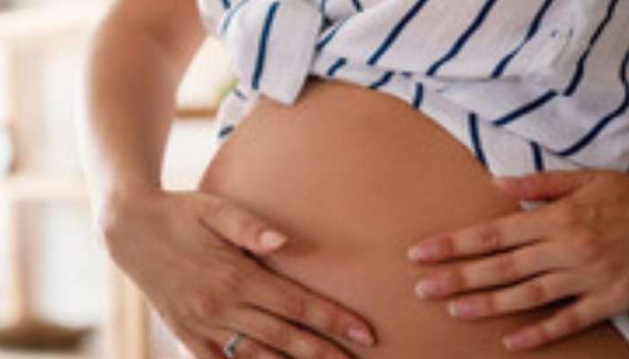 Remove Stretch Marks after Delivery Try these 5 home remedies 