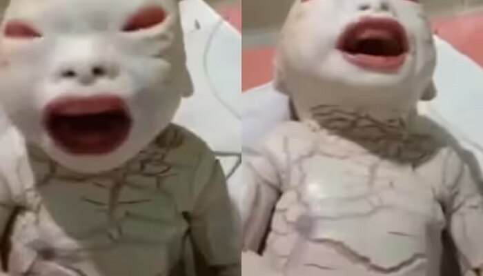 आई गं! महिलेने दिला &#039;एलियन&#039; सारख्या मुलाला जन्म, डॉक्टरांनाही बसला धक्का! Video Viral 