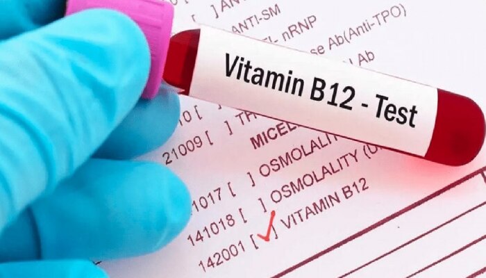 Vitamin B12 : वयोमानानुसार तुमच्या शरीरात व्हिटॅमीन बी 12 चं प्रमाण किती पाहिजे? जाणून घ्या!