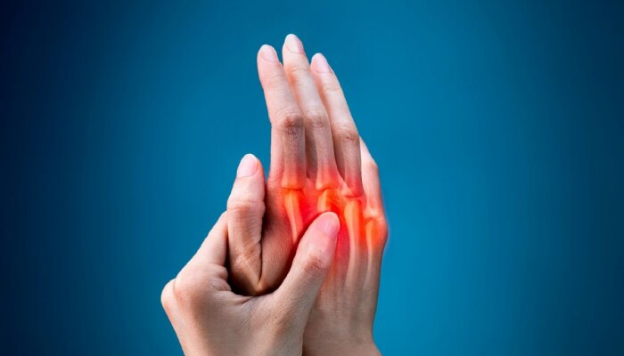 Rheumatoid arthritis : सांधेदुखीचा सतत त्रास होतोय? रूग्णांनी नियमित केली पाहिजे &#039;ही&#039; गोष्ट
