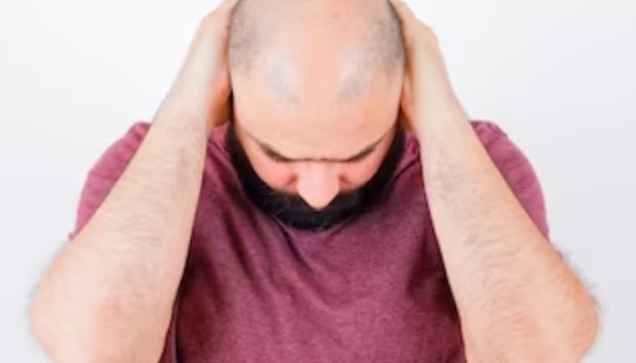 Men Baldness reason Purush Takkal samasya upay Health Tips Marathi News