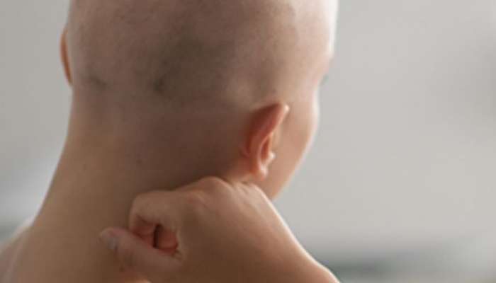 कॅन्सर उपचारात केस का गळतात? 