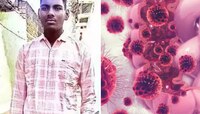 उंची तब्बल 7 फूट 2 इंच, दिसणं कमी झालं.. धक्कादायक कारण समोर, विचित्र आजाराने घेरलं 