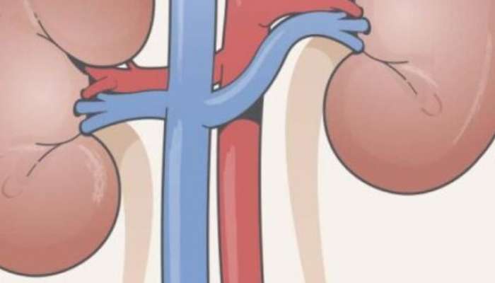 Kidney खराब झाल्याचे संकेत आहेत 'ही' लक्षणं!