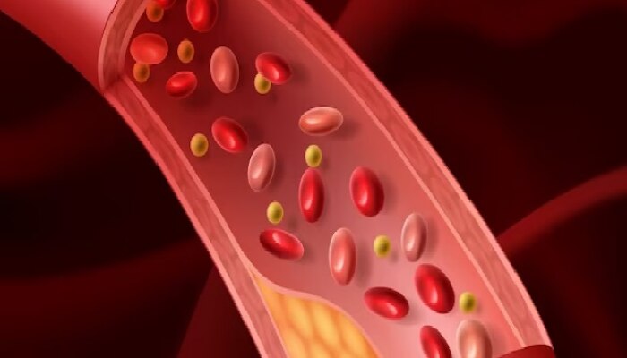 Cholesterol Symptoms: कोलेस्ट्रॉल वाढल्यावर शरीरातील &#039;या&#039; भागांमध्ये होतात वेदना!