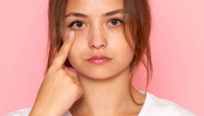 DARK CIRCLES,SKIN CARE TIPS,BEAUTY,BEAUTY TIPS,VITAMIN E CAPSULE,VITAMIN E CAPSULE TO REMOVE DARK CIRCLES, Vitamin-E, lifestyle, lifestyle news, health, health news, health news in marathi, lifestyle news in marathi, 