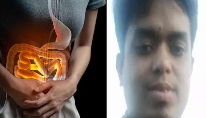 अकोल्यात नवीच दहशतः अवघड जागेच्या दुखण्यावर उपचार करणारा डॉक्टर निघाला फेक