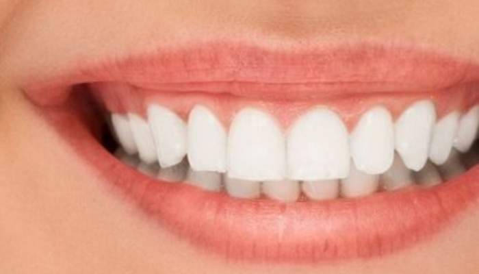 follow this 7 tips to keep your teeth white and clean
