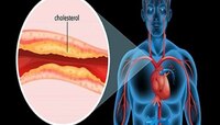 वयानुसार किती असावी cholesterol ची पातळी? जाणून घ्या एका क्लिकवर 