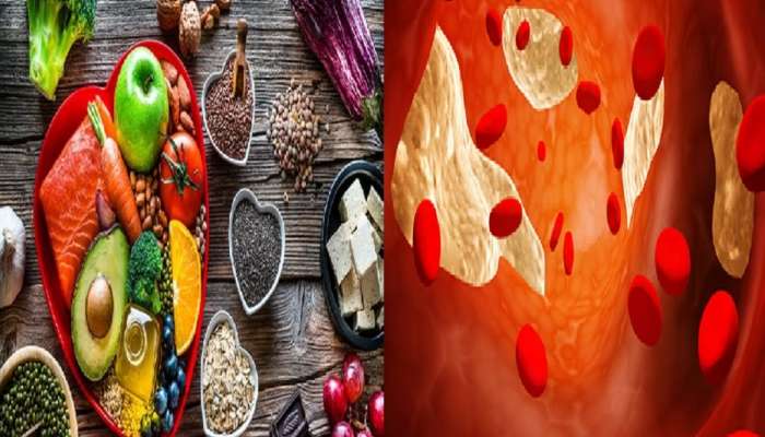 Cholesterol Symptoms: आयुष्यात कधीच वाढणार नाही कोलेस्टेरॉल, फक्त 'हे' पदार्थ खाणं सोडा!