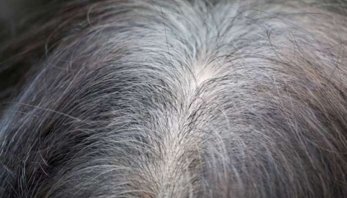  पांढरे झालेले केस पुन्हा होऊ शकतात का काळे? या पद्धतीनं करा घरगुती उपाय