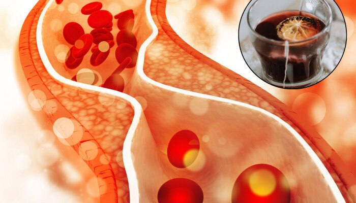 Bad Cholesterol ला मुळापासून दूर करण्यासाठी सकाळीच प्या &#039;हा&#039; चहा, रात्रीपर्यंत दिसेल फरक 