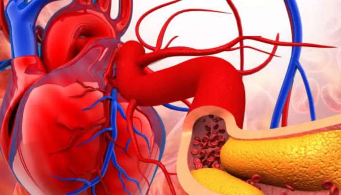 Health Tips : कोलेस्ट्रॉल आणि हार्ट अटॅकपासून दूर ठेवतो 'या' भाजीचा रस, आहारात करा समावेश
