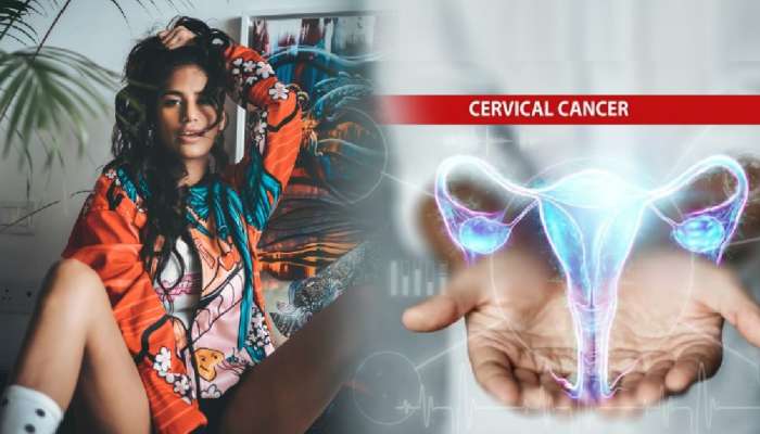 Cervical Cancer ने घेतला पूनम पांडेचा जीव! महिलांनो &#039;या&#039; 10 लक्षणांकडे करु नका दुर्लक्ष