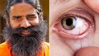 Eye Care : स्क्रीन टाईम वाढल्यामुळे डोळे जळजळतात? बाबा रामदेव यांचे उपाय करा फॉलो 