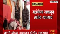 Manoj Jarange | डॉक्टरांचा हात झटकला! जरांगे यांच्या नाकातून वाहू लागलं रक्त; प्रकृती बिघडली