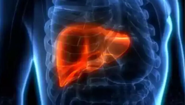 fatty liver life risk, causes, in marathi