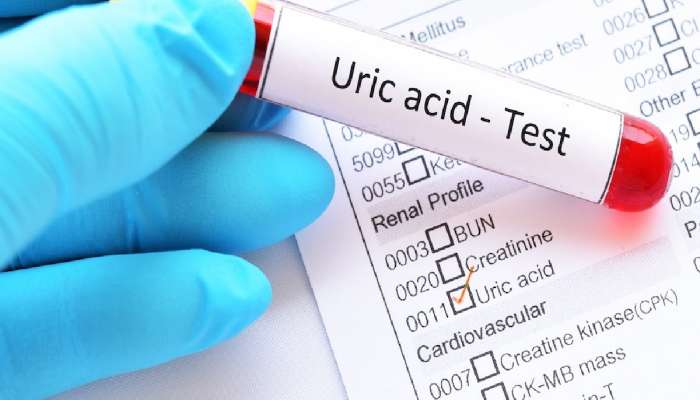 पुरुष आणि स्त्रियांमध्ये Uric Acid ची सामान्य पातळी किती असावी? पाहा चार्ट 