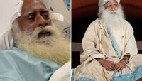 सद्गुरुंवर ब्रेन सर्जरी; जीवघेण्या आजारापासून वाचण्यासाठी तात्काख शस्त्रक्रिया
