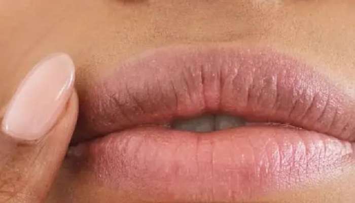 How to Get Rid of Dark Skin Around Mouth 