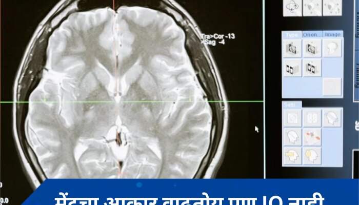 Gen Z : तरुणाईच्या मेंदूचा आकार वाढतोयस, पण IQ होतोय कमी, अभ्यासात समोर आली धक्कादायक माहिती? 