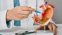 गॅस्ट्रोइंटेस्टाइनलच्या कोणत्या समस्या जाणवतात? पाहा त्याची लक्षणं