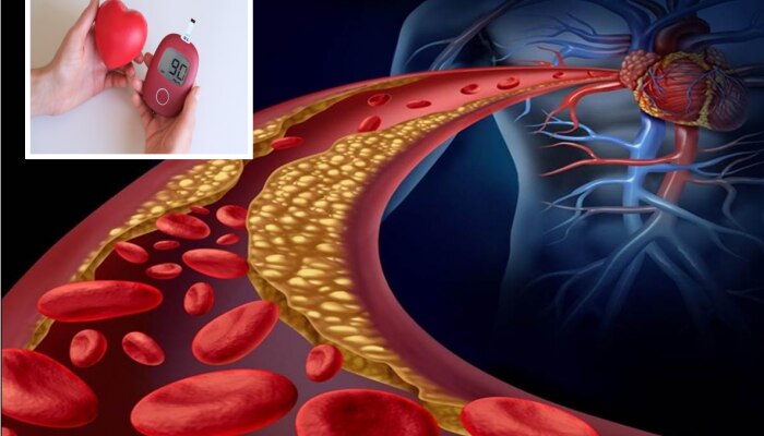 Cholesterol Reduce Food: &#039;हा&#039; पांढरा पदार्थ करतो कोलेस्ट्रॉलचा नाश, Heart Attack, डायबिटीज ठेवते कंट्रोलमध्ये?