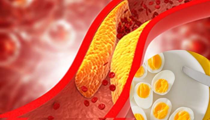 High Cholesterol असल्यास अंडी खाणे कितपत फायदेशीर? पाहा काय सांगतात तज्ञ्ज