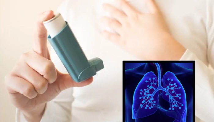 World Asthma Day: वायू प्रदूषणामुळे वाढतोय दम्याच्या रूग्णांचा त्रास; कशी घ्याल काळजी?
