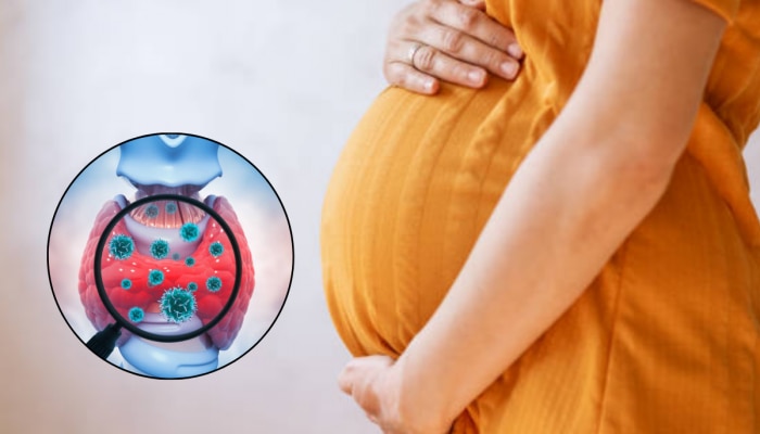 मातेला गर्भधारणे दरम्यान थायरॉईड असल्यास बाळावर काय परिणाम होतो? कोणत्या टेस्ट महत्त्वाच्या 