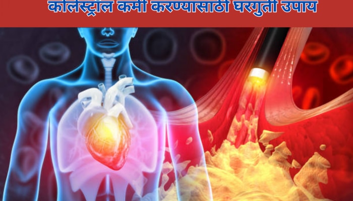 नसांमध्ये चिटकून राहिलेला घाणेरडा कोलेस्ट्रॉल घरीच करा कंट्रोल, 6 पदार्थांनी सहज बाहेर फेकेल