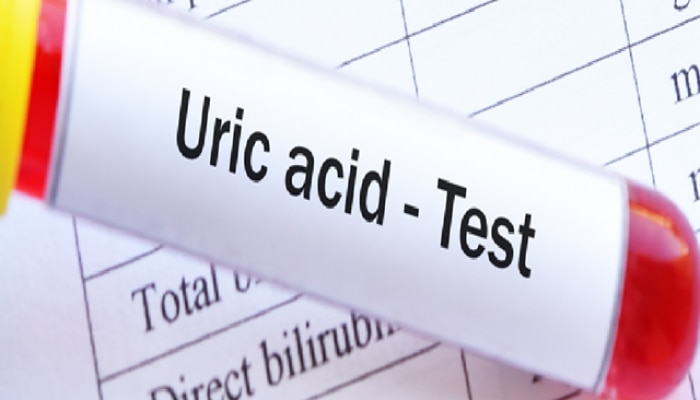 Uric Acid चाचणी कधी करावी? 