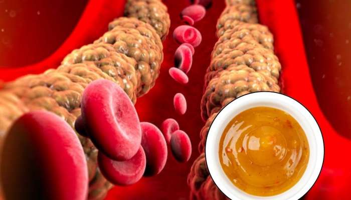 लिंबाची चटणी: नसांमध्ये जोडलेला खराब कोलेस्ट्रॉल खेचून काढेल 'ही' पिवळी चटणी, घरची तयार करा