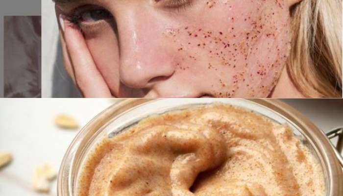 Glowing skin in 5 minutes No need to go to a parlour, make scrub at home